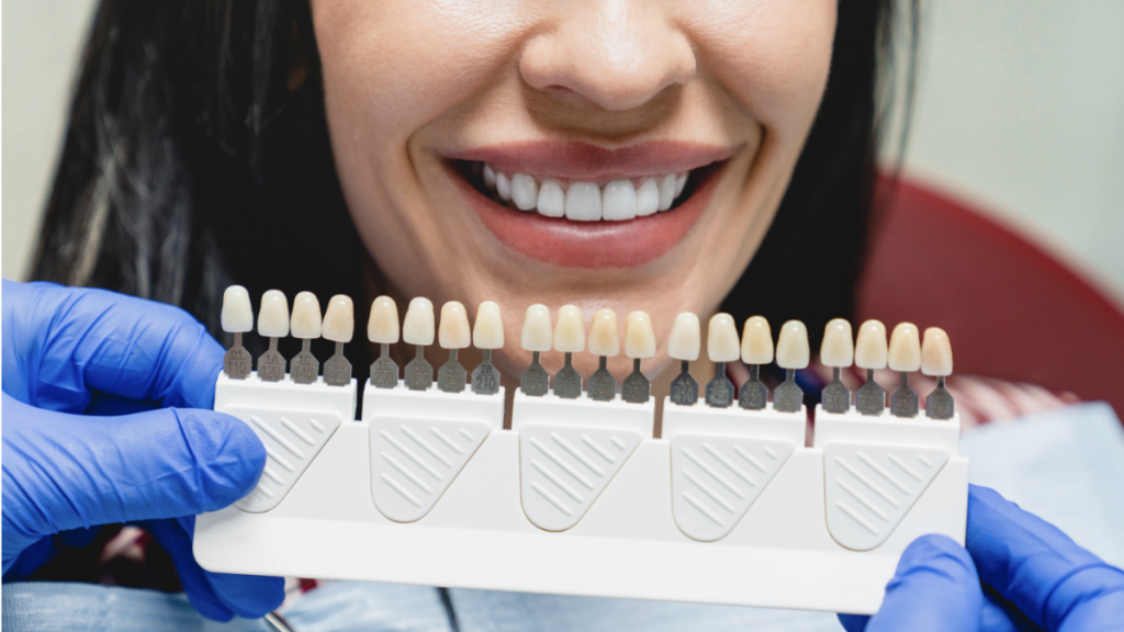 INTRODUCTION TO DENTAL VENEERS