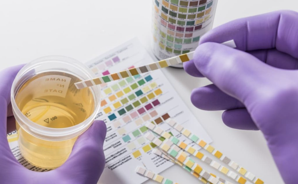 Navigating Pre-Employment Drug Testing What You Need to Know